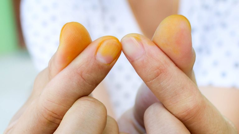 https://www.tastingtable.com/1557862/white-vinegar-tip-removes-turmeric-stains/